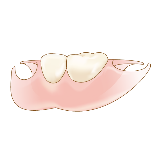 ノンメタルスラスプ義歯