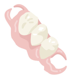 ノンスクラプデンチャー