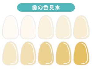 歯の色